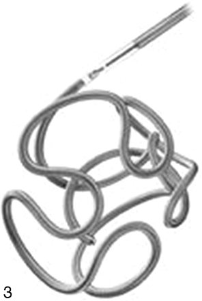 Fig 3.