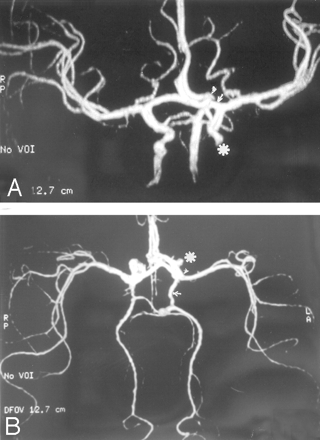 Fig 2.