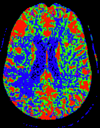 Fig 1.
