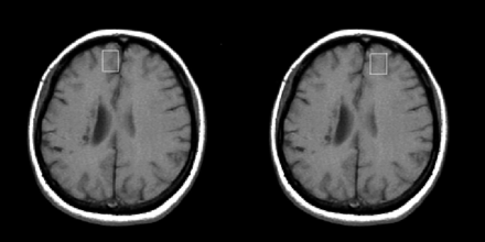 Fig 1.