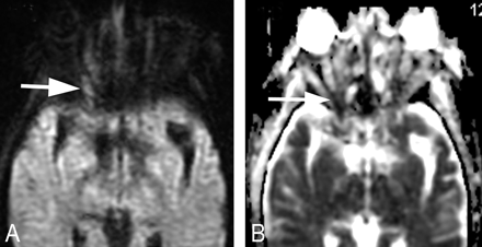 Fig 1.