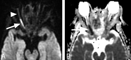 Fig 2.
