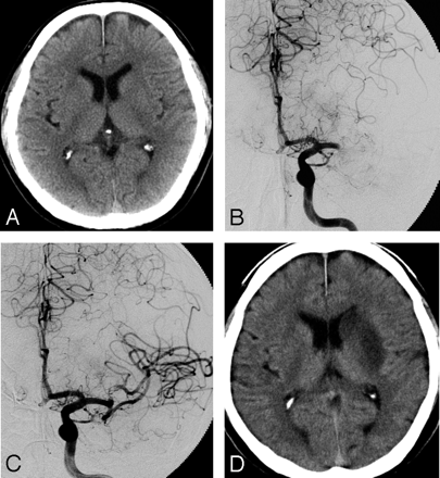 Fig 3.
