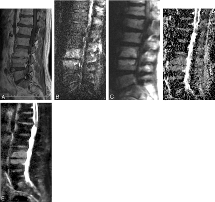 Fig 3.