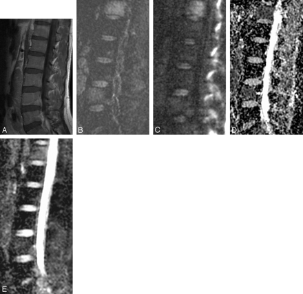 Fig 4.