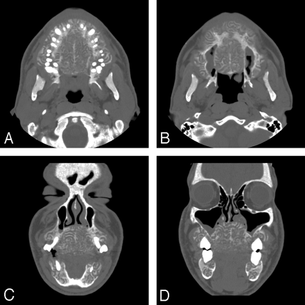 Fig 2.