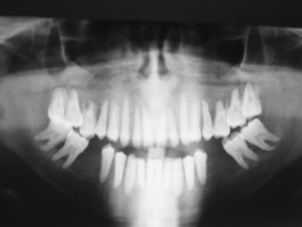 Fig 3.