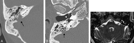Fig 1.