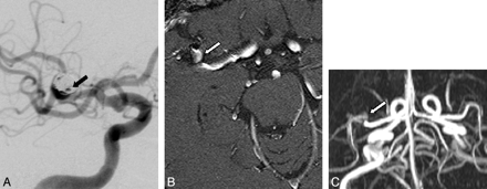Fig 3.