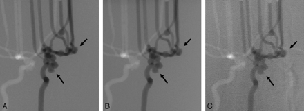 Fig 4.
