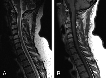 Fig 3.