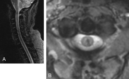 Fig 4.