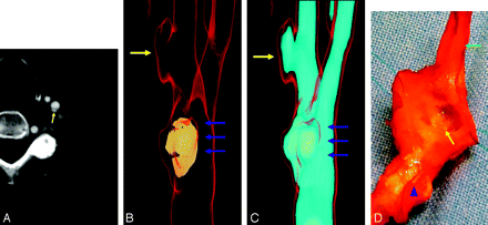 Fig 2.