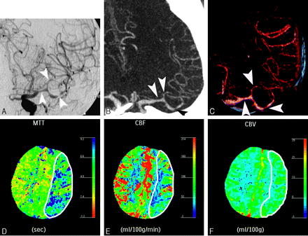 Fig 2.