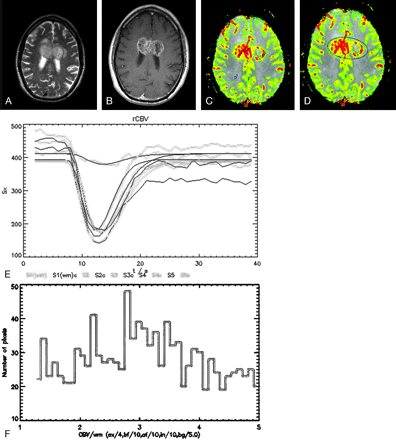 Fig 3.