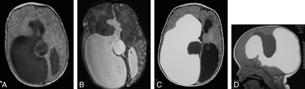 Fig 1.