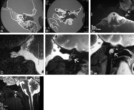 Fig 4.