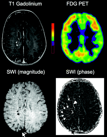 Fig 3.