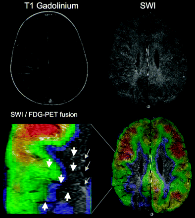 Fig 4.