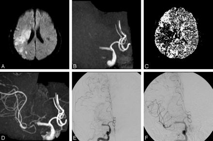 Fig 2.