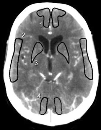 Fig 1.