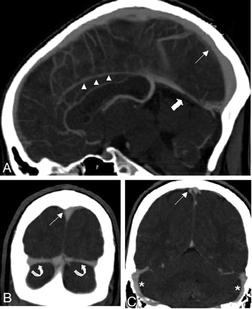 Fig 1.