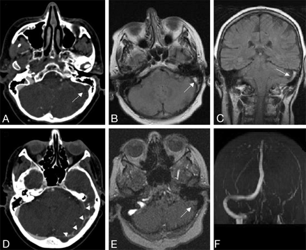 Fig 4.