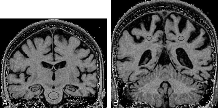 Fig 1.