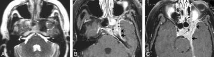 Fig 1.