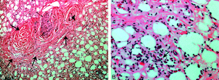 Fig 2.