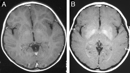 Fig 1.