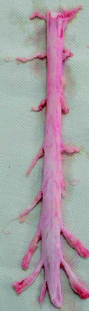 Fig 3.