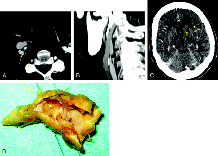 Fig 1.
