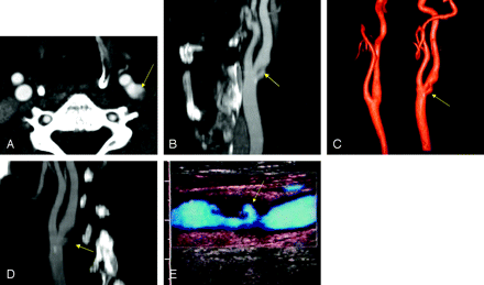 Fig 2.