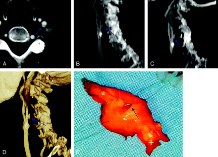 Fig 3.