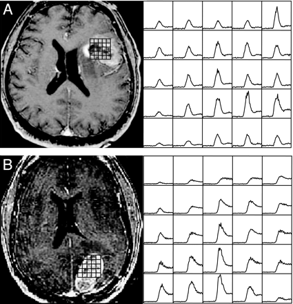 Fig 3.