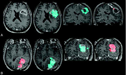 Fig 4.