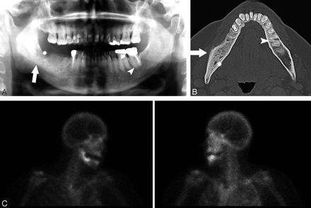 Fig 3.