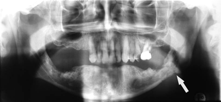 Fig 9.
