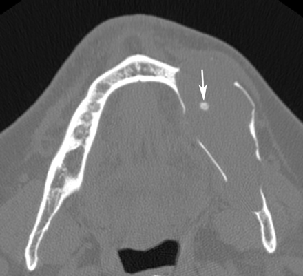 Fig 1.