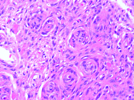 Fig 2.