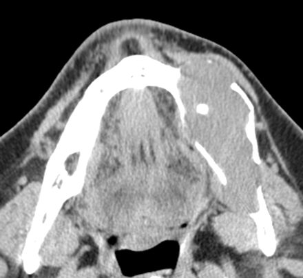 Fig 3.