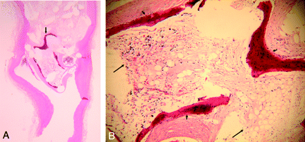 Fig 1.