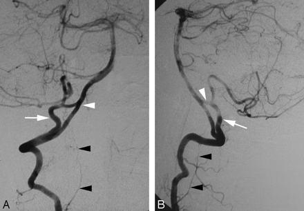 Fig 6.