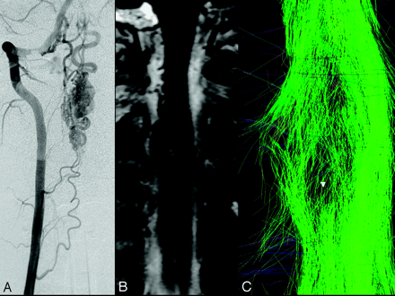 Fig 3.
