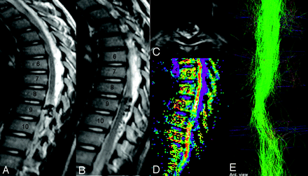 Fig 4.
