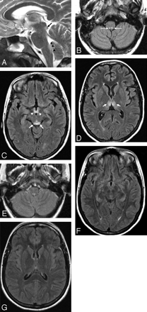 Fig 3.