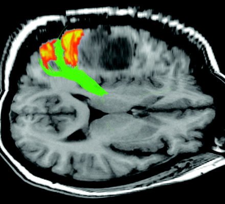 Fig 3.