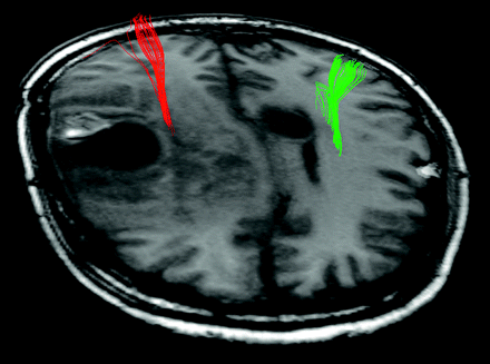 Fig 4.