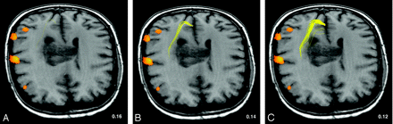 Fig 5.